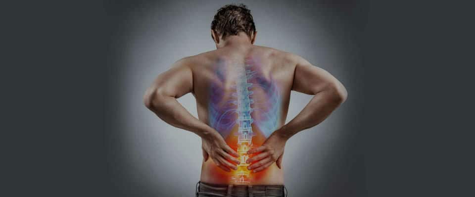 back-pain bunbury physiotherapist